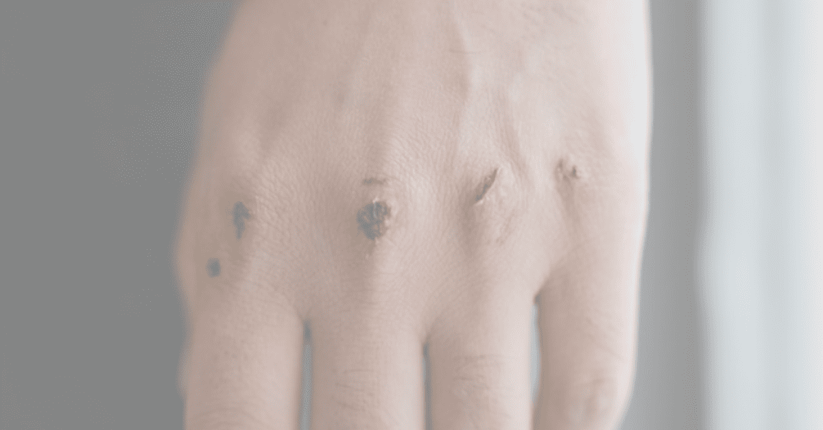 Herb Grinders for Those Suffering from Arthritis & Hand Injuries